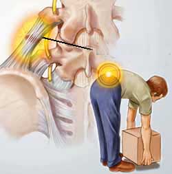 Phương pháp nào điều trị đau lưng do tư thế