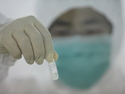 Hỏi: Văcxin dạng xịt ngừa cúm A/H1N1 