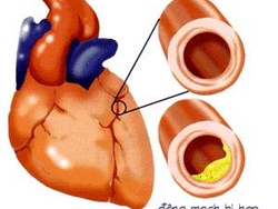 Điều trị tăng huyết áp ở bệnh nhân bệnh động mạch vành